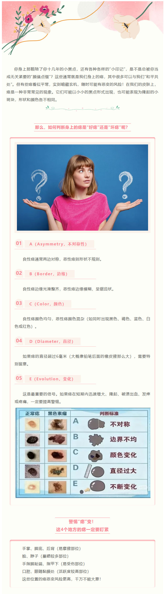 身上的痣安全吗？别让“颜值点缀”变成健康隐患！商城县人民医院医疗美容科来支招_01.jpg