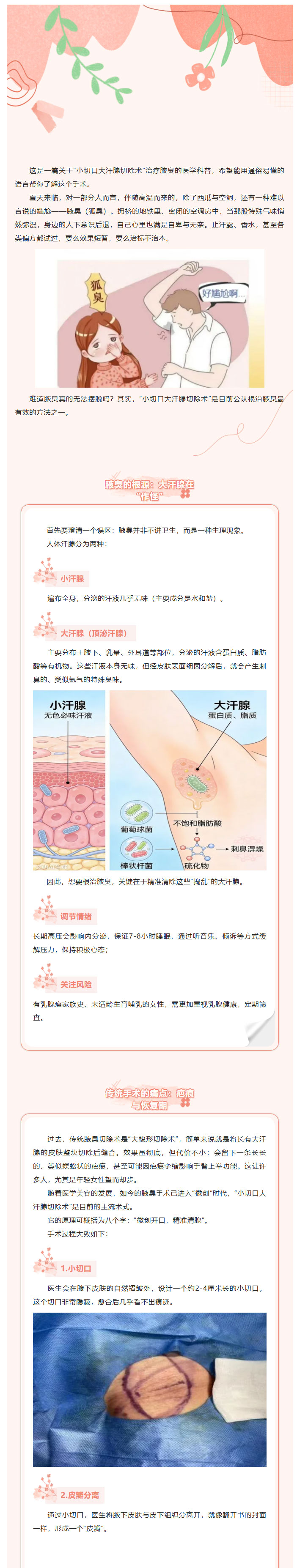 告别“腋”来香，只需一个小切口：关于腋臭手术的真相_01.jpg